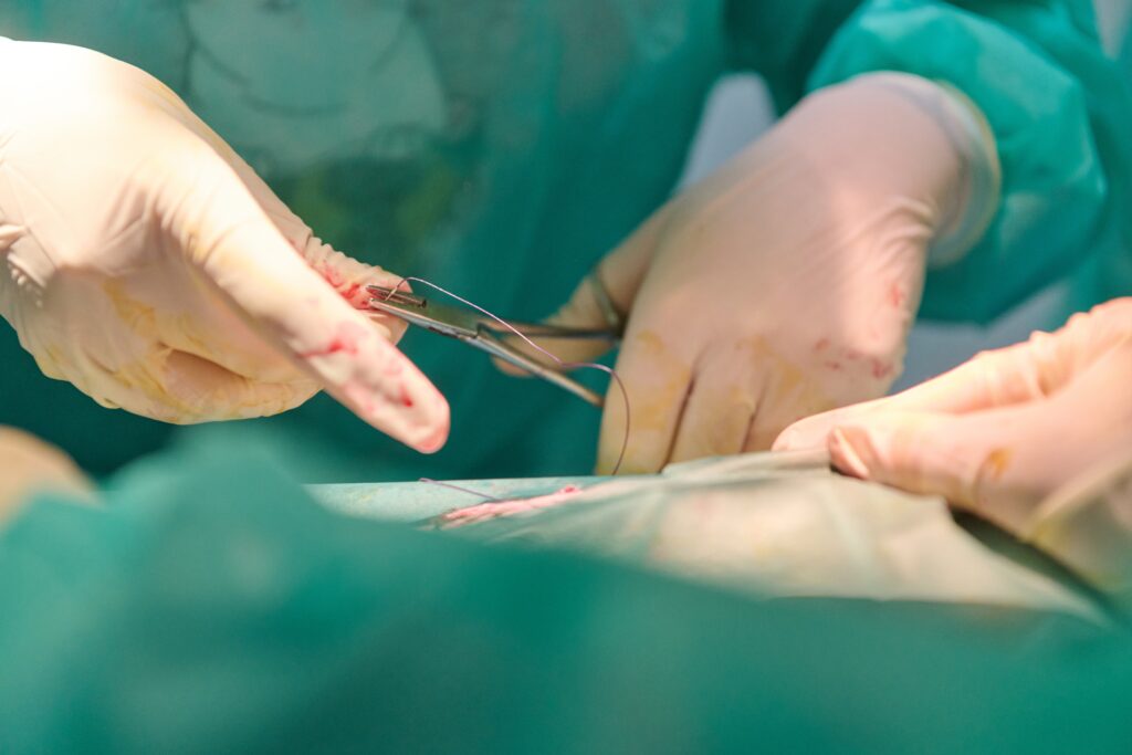 性別適合手術の様子