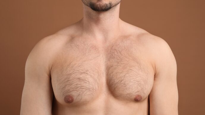 ホルモン療法により体毛が増えたトランス男性